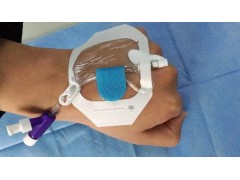 一次性使用導管固定裝置