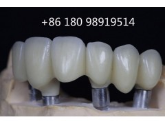 專業牙科診所義齒供應商Myy國際代理合作