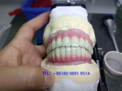 種植牙Dental Implant外貿出口